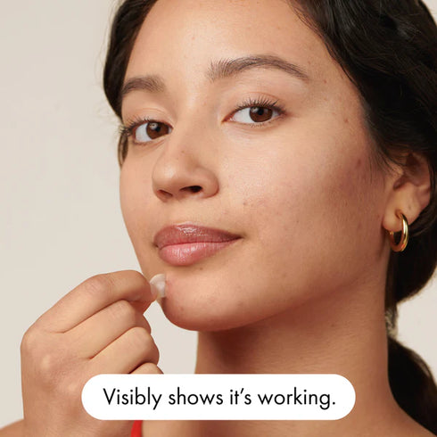 Hero Mighty Patch  Matakana Pharmacy